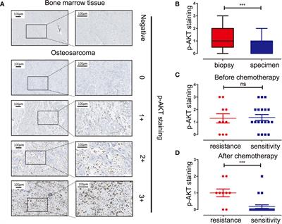 Pictilisib Enhances the Antitumor Effect of Doxorubicin and Prevents Tumor-Mediated Bone Destruction by Blockade of PI3K/AKT Pathway